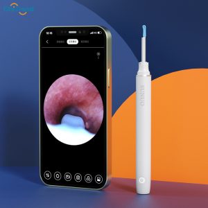 Bộ vệ sinh tai nội soi đa năng Sunuo FIND X - Pin 60 phút