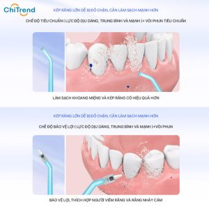 Máy tăm nước BOMIDI D3 Pro 300ml - PIN 80 ngày